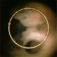 Your Baby at 10 Weeks